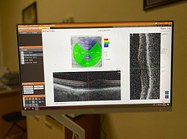В Университете появился уникальный прибор для диагностики глаз Solix Optovue