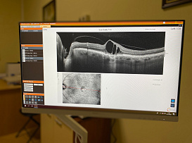 В Университете появился уникальный прибор для диагностики глаз Solix Optovue