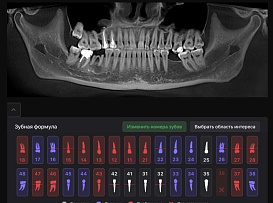 Врачи стоматологической поликлиники БГМУ используют искусственный интеллект для изготовления протезов