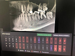 Врачи КСП БГМУ используют технологии цифровой стоматологии для более точной постановки диагноза