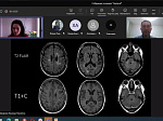 A meeting of the English MRI club in the diagnosis of diseases of the nervous system was held at the Department of Neurology