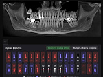 Врачи стоматологической поликлиники БГМУ используют искусственный интеллект для изготовления протезов